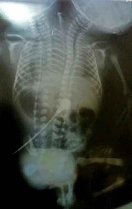 x-ray-baby