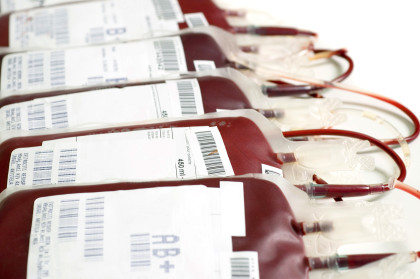 Blood transfusion during oncosurgery increases cancer recurrence risk Blood transfusion during oncosurgery increases cancer recurrence risk