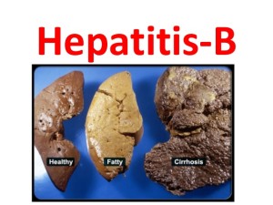 WHO guidelines on Chronic Hepatitis B