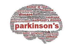 New gene mutation linked to onset of Parkinsons