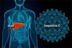 New Drug  effective against resistant hepatitis C found