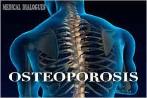 Elderly patients of hip or spine fracture to be treated for osteoporosis