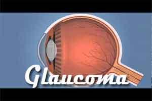 Glaucoma Treatment: Optic nerve regeneration may hold the key