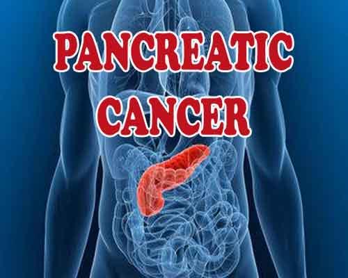 Persistent high blood sugar increases pancreatic cancer