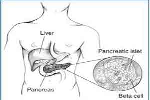 Researchers identify prognostic indicators of survival following pancreatic tumor removal