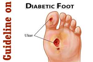 NICE Guidelines on Diabetic foot problems: prevention and management
