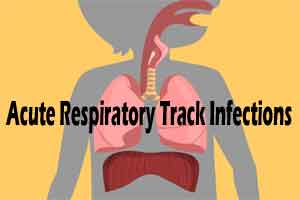 ACP Guidelines 2016 for Antibiotic Use in Acute Respiratory Track Infections