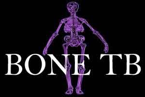 Bone TB is the prime cause for bone spine deformities