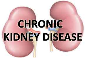 Secondhand smoke associated with higher risk of chronic kidney disease