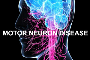 NICE Guideline on Assessing and Managing Motor Neurone Disease