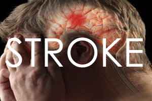 Stroke risk after heart attack persists for months : Study