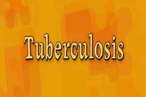Blood test to predict risk of developing Mycobacterium TB