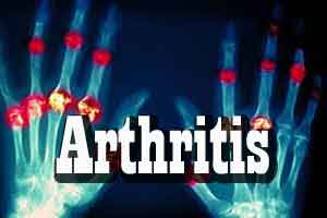 Treating arthritis with algae