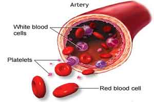 Dual Anti-Platelets in CAD: When and How Long ( ACC/AHA update 2016)