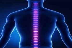 Newly developed spongy polymer can help repair spine