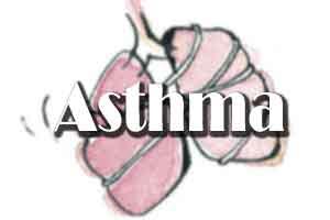 Women suffer from asthma symptoms more frequently and more severely than men