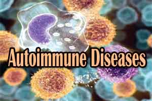 What autoimmune diseases are more prevalent in women than in men: Study finds important clue