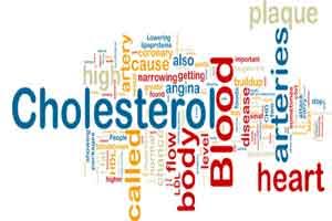 Low HDL cholesterol may help monitor long-term, average high triglyceride levels