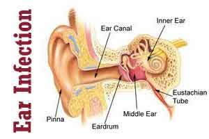 Don’t treat common ear infections with antibiotics, says NICE