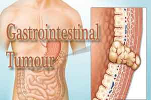 Gastrointestinal tumours associated with higher mortality
