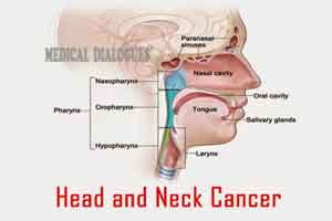 Early detection of head and neck cancers is the foremost path of cure