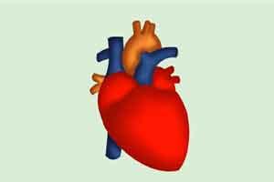 Calcium build-up in arteries a predictor of heart attack : JACC