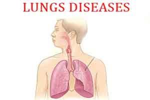 New therapeutic approach for advanced lung disease