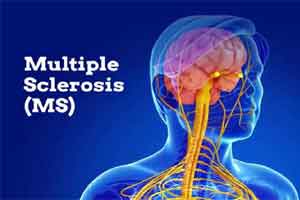 New hope for treatment of multiple sclerosis : AAN Annual Meeting