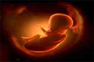 Obesity and Diabetes in Pregnancy Hastens Early Foetus Growth