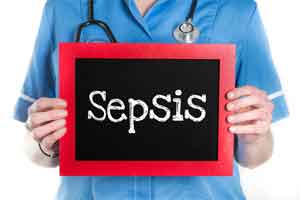 Septic shock with no diagnosis at 24 hours: Critical care study