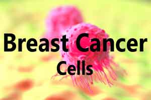 Breast cancer linked to bacterial imbalances