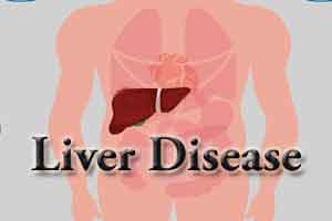 New targets for drugs to treat fatty liver disease and liver cancer