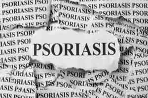 Adherence to mediterranean diet decreases severity of psoriasis