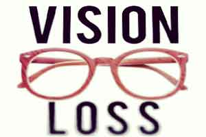 A case of Painless Loss of Vision after Vomiting