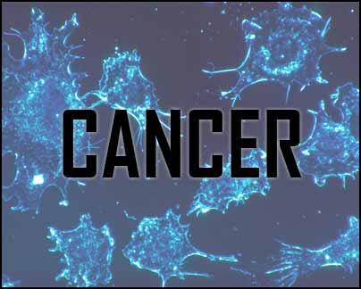 New, non-invasive method to wipe out cancerous tumors: study