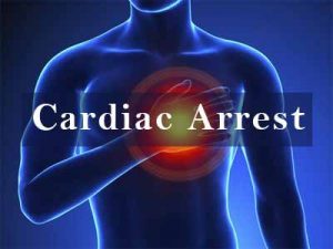 Timely Intervention saves the life of a 22 year-old who suffered a sudden cardiac arrest