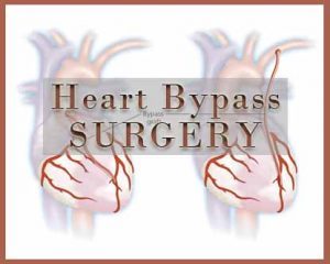 Scientists Develop New Heart Bypass Surgery Device