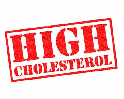 High cholesterol linked with Osteoarthritis: Study