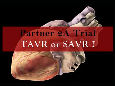 Cardiology Update: Partner 2A trial