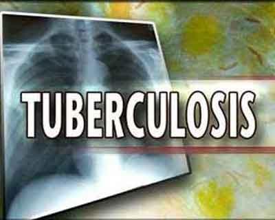 Prevention of Tuberculosis: NICE Guidelines