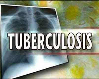 Lung TB may be cured with shorter treatment regimen