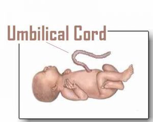 Umbilical cord blood improves motor skills in some children with cerebral palsy