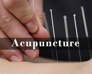 Acupuncture plus topical ibuprofen good for chronic knee pain relief in osteoarthritis