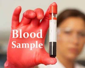FDA warns LeadCare tests not to be used with venous blood samples