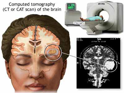 Brain CT-ACR Practice Parameters 2015