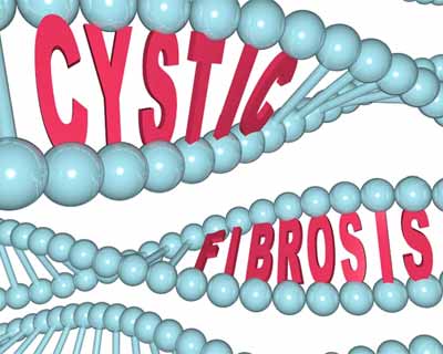 Antioxidant Supplements may reduce exacerbations in cystic fibrosis