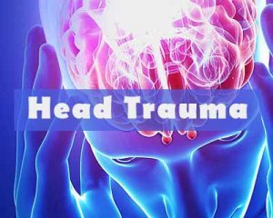 Pediatric law and radiology experts define abusive head trauma