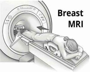 Has breast MRI been performed upside down?