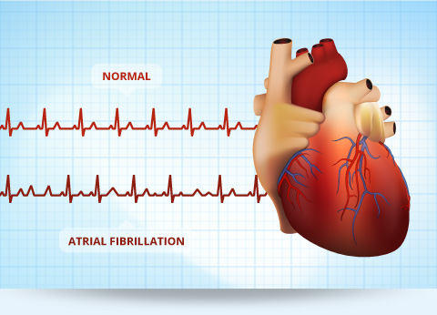 Amiodarone increases risk of falls and fainting in elderly, finds study