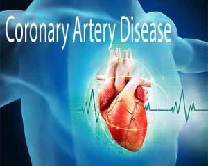 Coronary artery disease up by 300 per cent in India in the past 3 decades